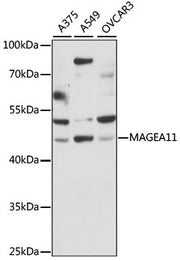 MAGEA11 Rabbit pAb