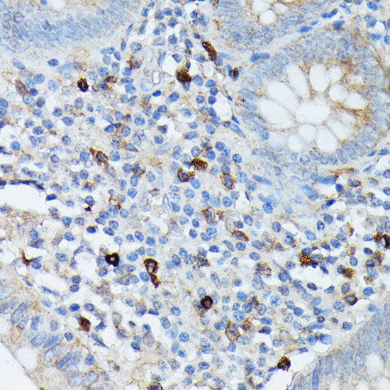 RNASE6 Rabbit pAb