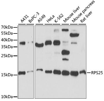 RPS25 Rabbit pAb
