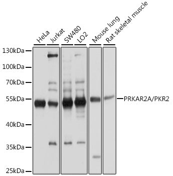 [KO Validated] PKA RIIα (PRKAR2A) Rabbit pAb
