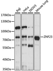 ZNF23 Rabbit pAb