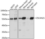 ZSCAN21 Rabbit pAb