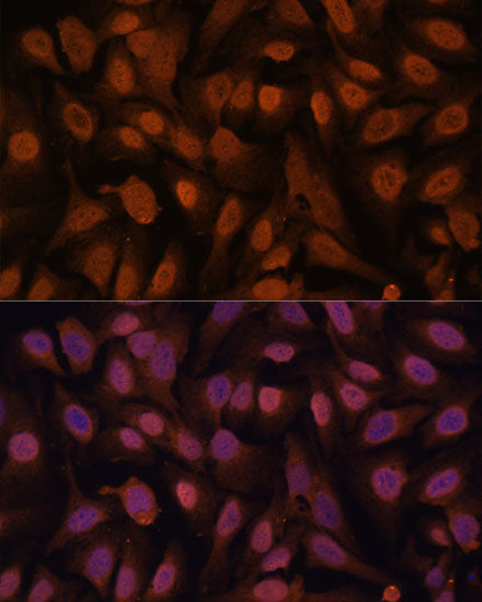ZNF131 Rabbit pAb