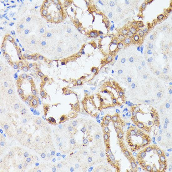 PTP4A2 Rabbit pAb