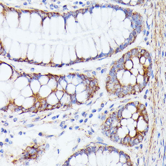 PTP4A2 Rabbit pAb