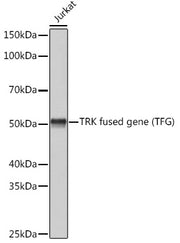 TRK fused gene (TFG) Rabbit mAb