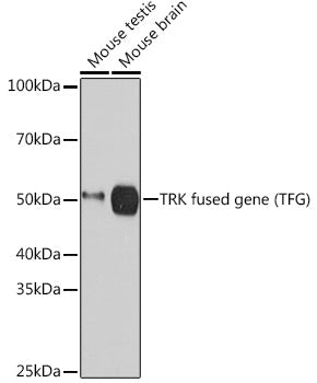 TRK fused gene (TFG) Rabbit mAb