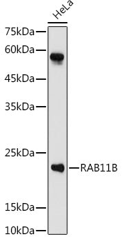 RAB11B Rabbit pAb