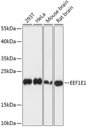 EEF1E1 Rabbit pAb