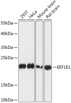EEF1E1 Rabbit pAb