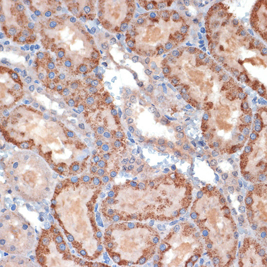 TIMM50 Rabbit mAb