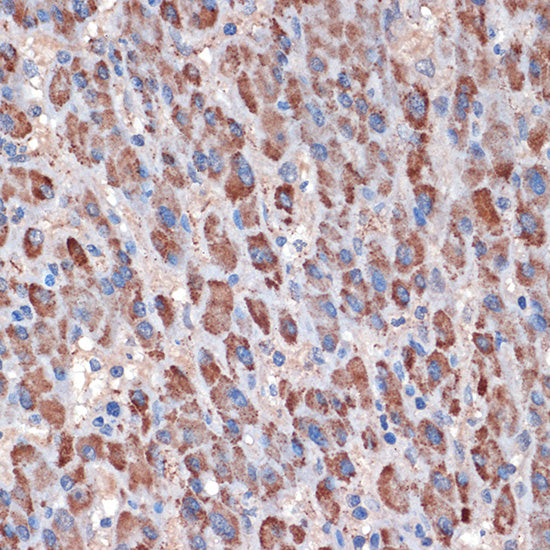 TIMM50 Rabbit mAb