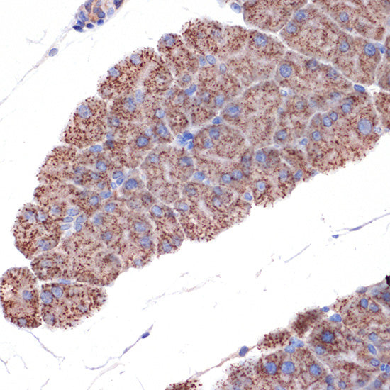 TIMM50 Rabbit mAb