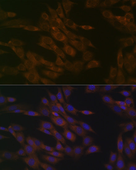 TIMM50 Rabbit mAb
