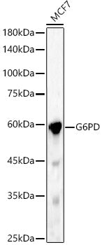 G6PD Rabbit pAb