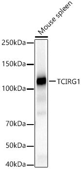 TCIRG1 Rabbit pAb