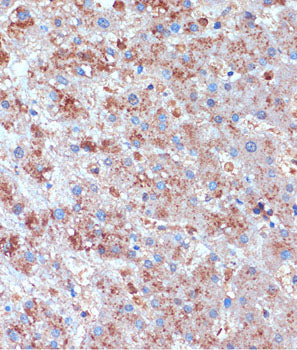 TCIRG1 Rabbit pAb