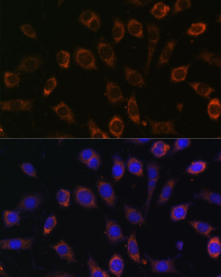 TCIRG1 Rabbit pAb