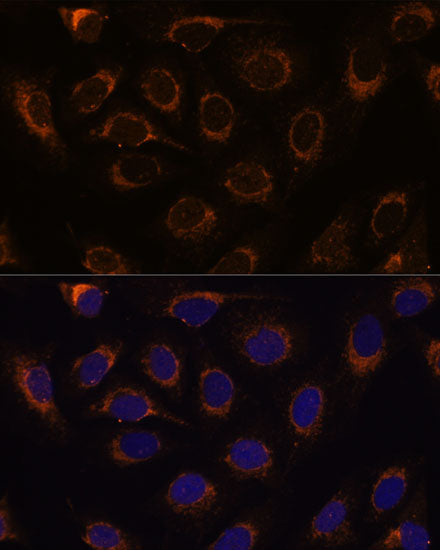 TCIRG1 Rabbit pAb