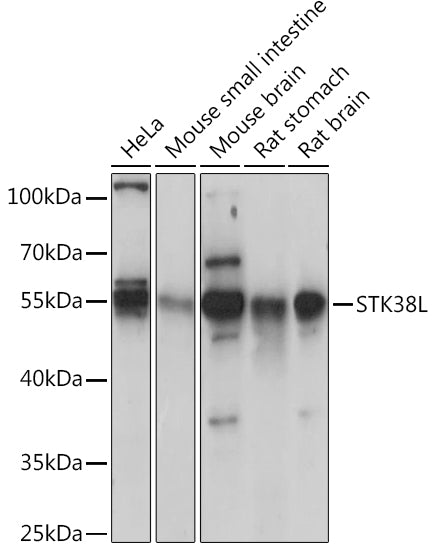 STK38L Rabbit pAb