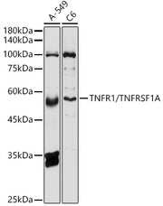TNFR1/TNFRSF1A Rabbit pAb