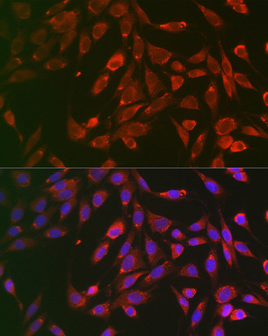 TNFR1/TNFRSF1A Rabbit pAb