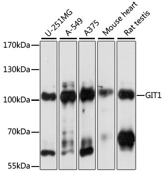 [KO Validated] GIT1 Rabbit pAb
