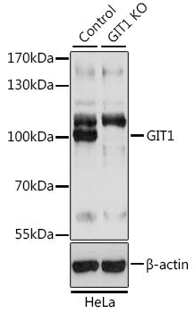 [KO Validated] GIT1 Rabbit pAb
