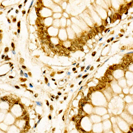 CDK6 Rabbit pAb