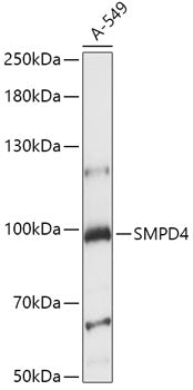 SMPD4 Rabbit pAb