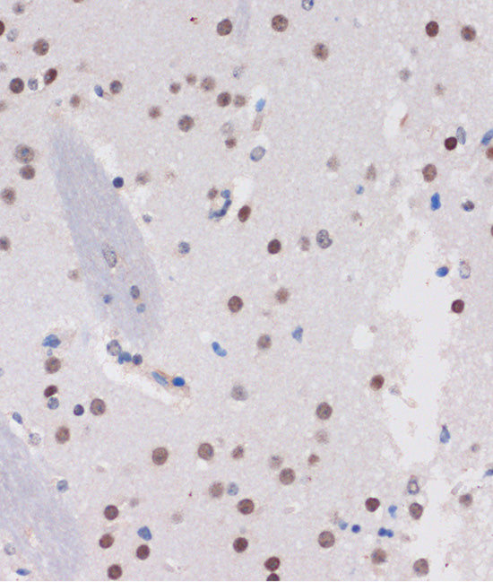 ARID1B Rabbit pAb