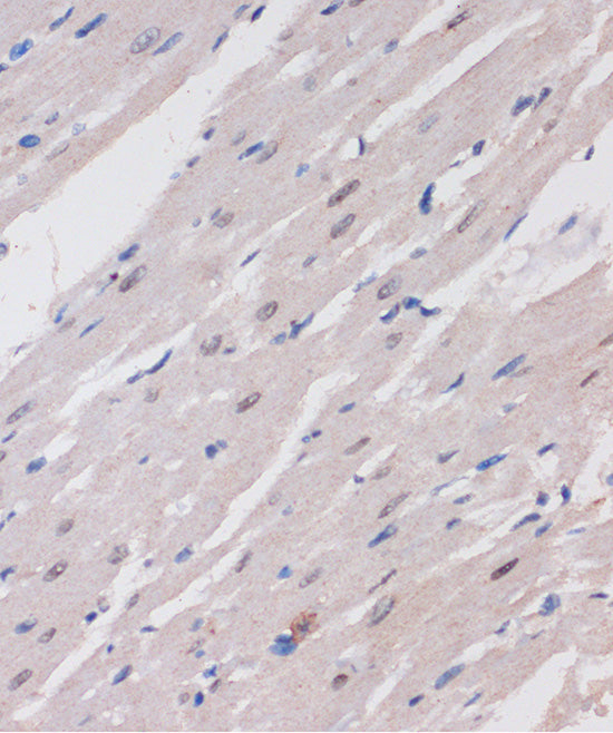 ARID1B Rabbit pAb