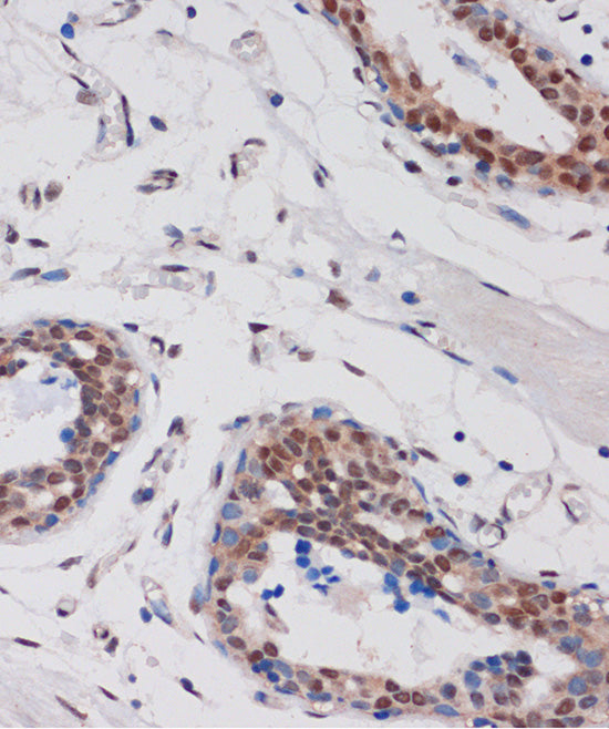 ARID1B Rabbit pAb