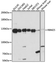 RBM25 Rabbit pAb
