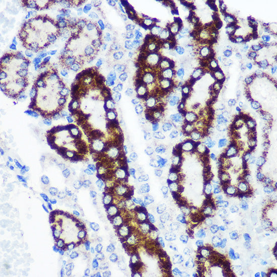 FCHSD1 Rabbit pAb