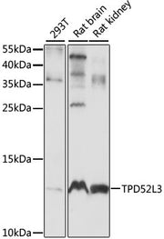 TPD52L3 Rabbit pAb