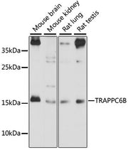 TRAPPC6B Rabbit pAb