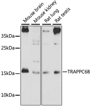 TRAPPC6B Rabbit pAb