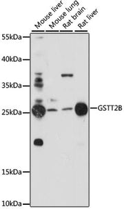 GSTT2B Rabbit pAb