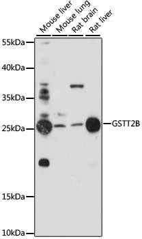 GSTT2B Rabbit pAb