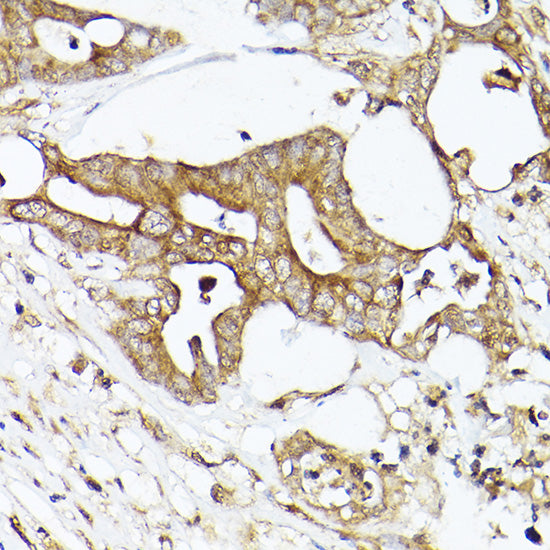 ACC1 Rabbit pAb