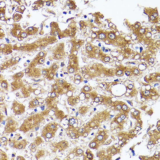 ACC1 Rabbit pAb