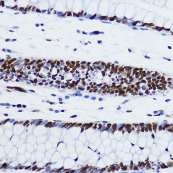 Acetyl-Histone H2B-K12 Rabbit pAb