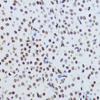 Acetyl-Histone H2B-K12 Rabbit pAb