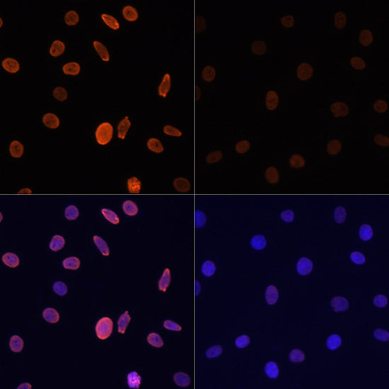 Acetyl-Histone H2B-K12 Rabbit pAb