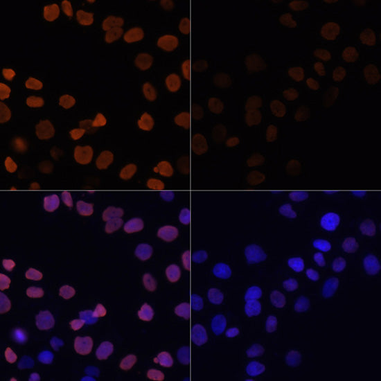Acetyl-Histone H2B-K12 Rabbit pAb