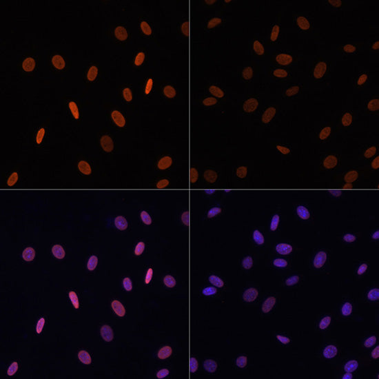 Acetyl-Histone H2B-K12 Rabbit pAb