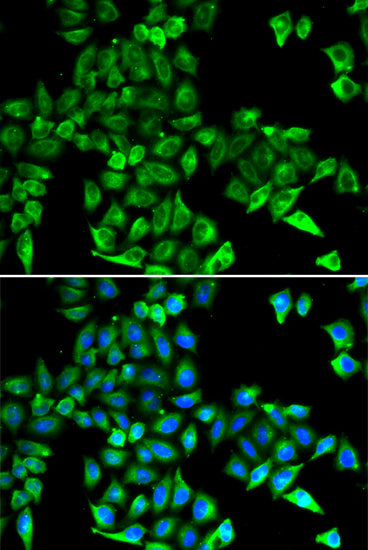 Cystatin C Rabbit pAb