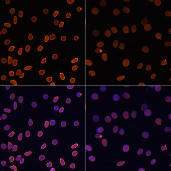 Acetyl-Histone H2A-K5 Rabbit pAb