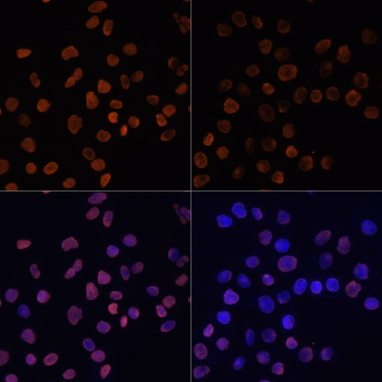 Acetyl-Histone H2A-K5 Rabbit pAb